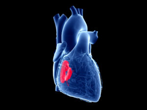 illustration of Tricuspid Valve