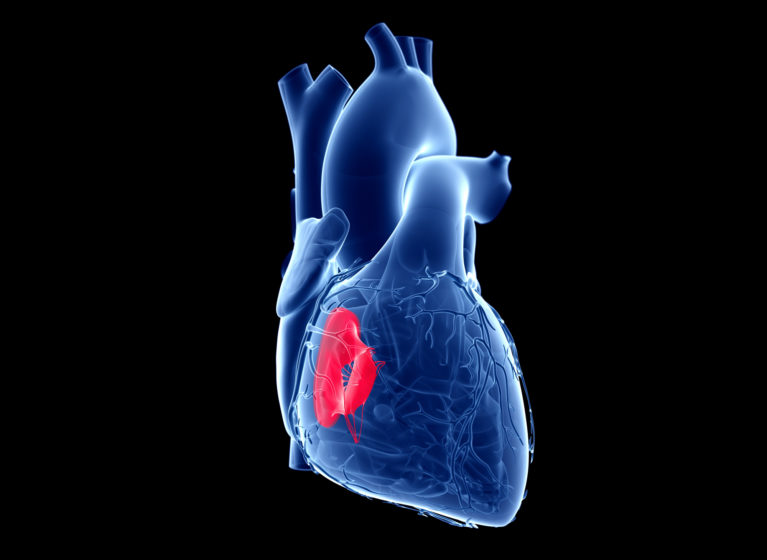 illustration of Tricuspid Valve