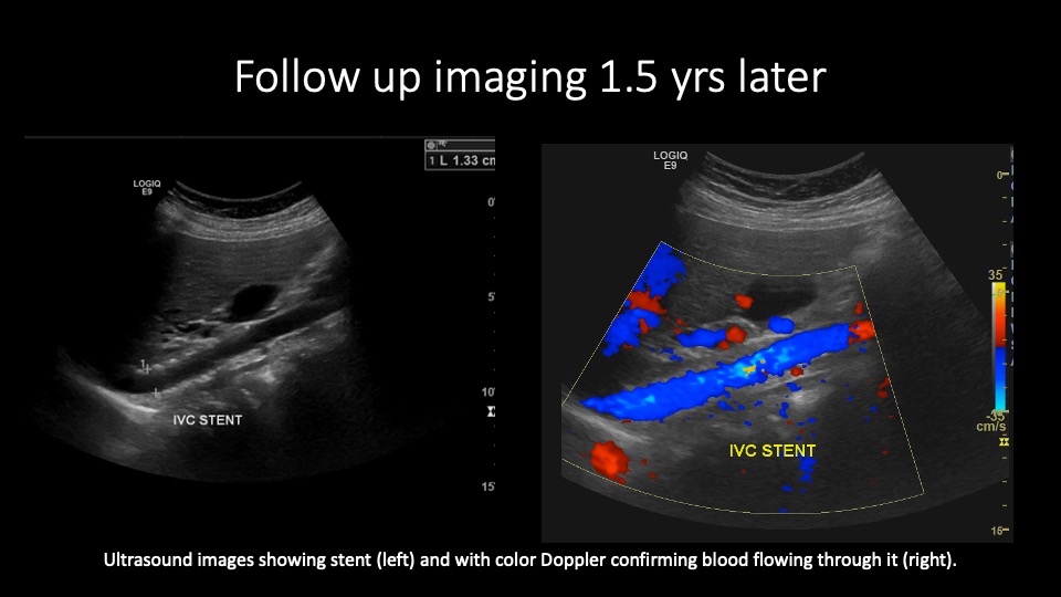 follow up image