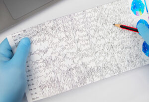 A sheet showing an image of an electroencephalogram (EEG).