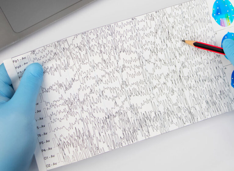 A sheet showing an image of an electroencephalogram (EEG).