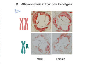 atherosclerosis in male and female arteries