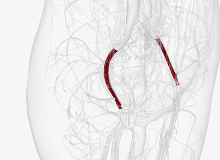 External iliac artery highlighted on a diagram of the hip area